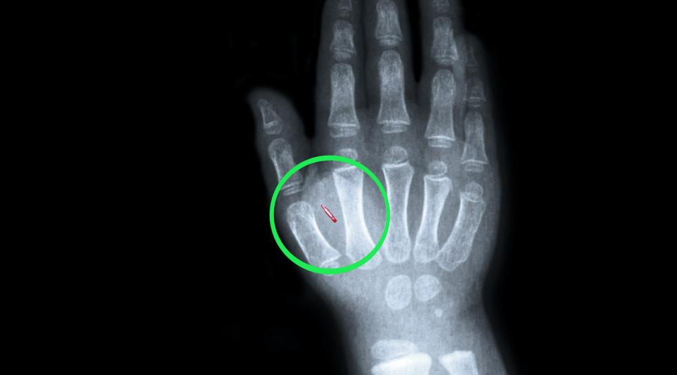 thumb